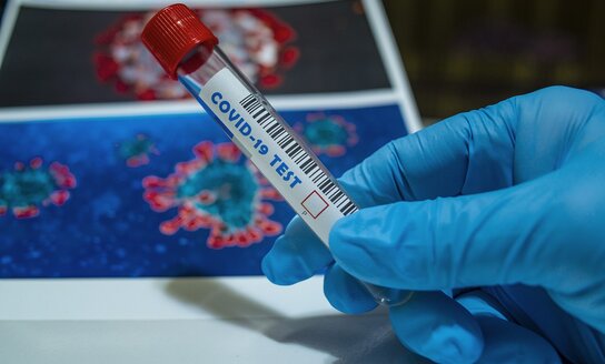 Visagine nustatytas naujas COVID-19 infekcijos atvejis