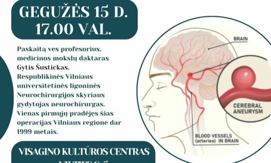 Kviečia į nemokamą paskaitą „Galvos smegenų arterijos aneurizma – ar žinote, kaip ją atpažinti...